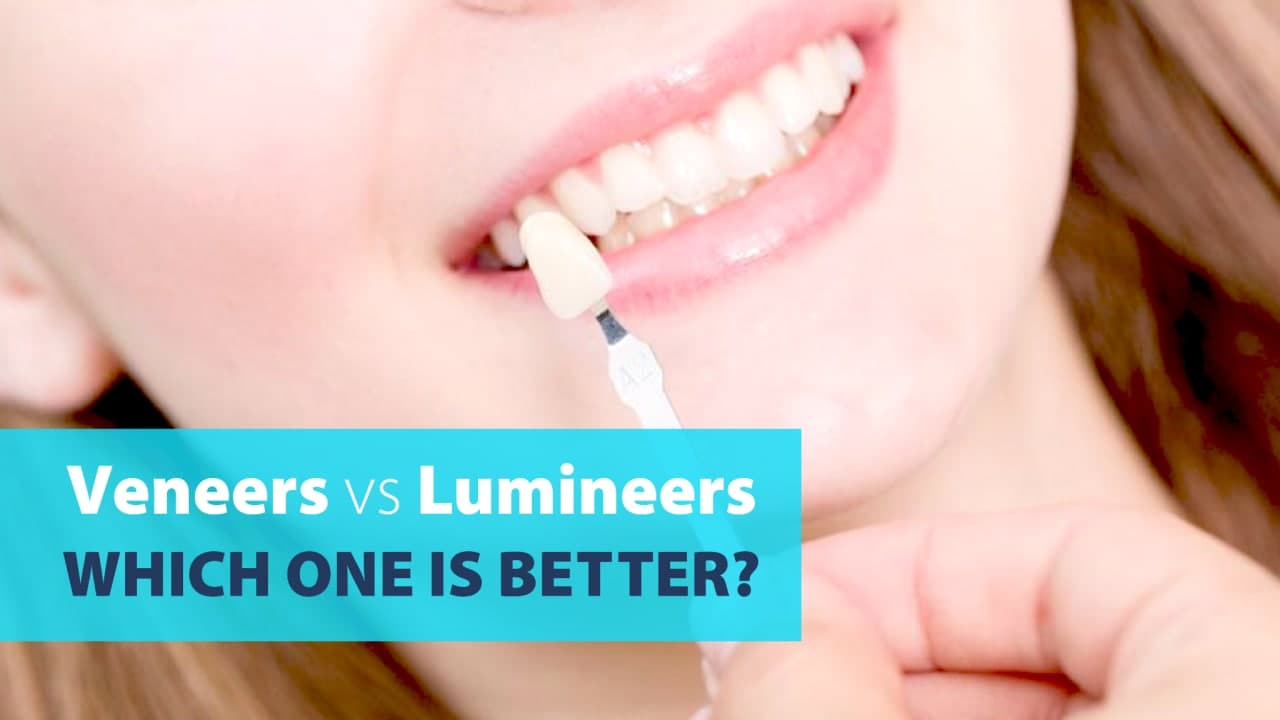 Veneers vs Lumineers, Which One Is Better? - Coming Soon in UAE