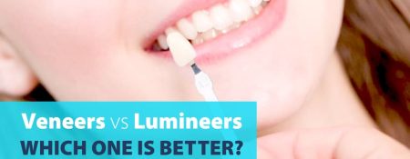 Veneers vs Lumineers, Which One Is Better? - Coming Soon in UAE