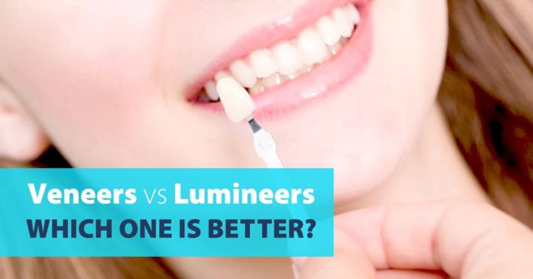 Veneers vs Lumineers, Which One Is Better? - Coming Soon in UAE